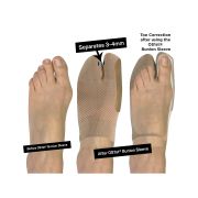 HV3 Bunion Bracing Sleeve